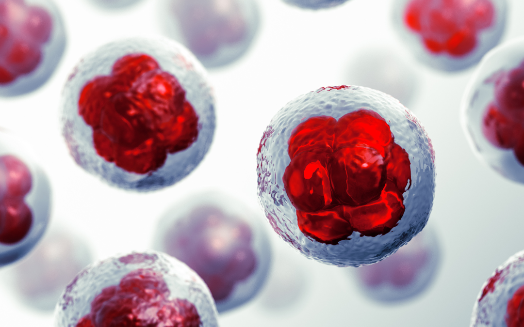 Células inmunes en la endometriosis peritoneal