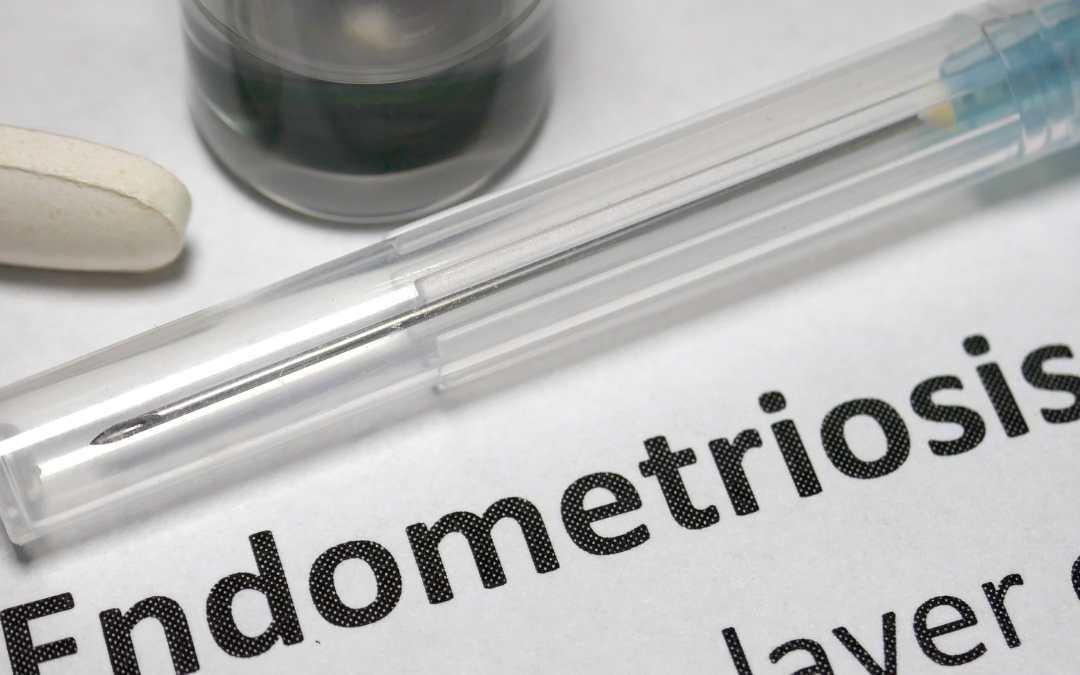 Cambios epigenéticos en la endometriosis: una nueva área objetivo para la terapia